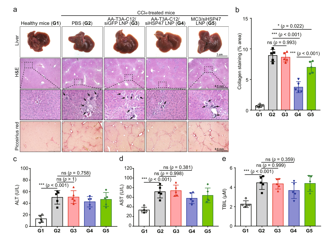 Figure 6a-e: Liver histology, collagen deposition and serum biochemistry in the fibrosis study.