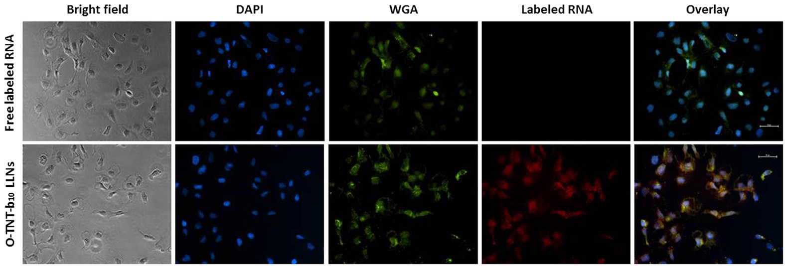 Figure 5: Fluorescence microscopy of RNA uptake into Hep 3B cells.